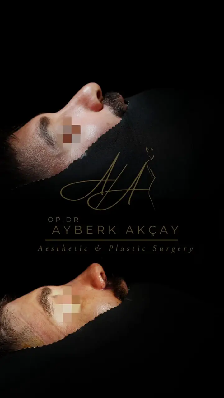 Op. Dr. Ayberk Akçay video arşivi